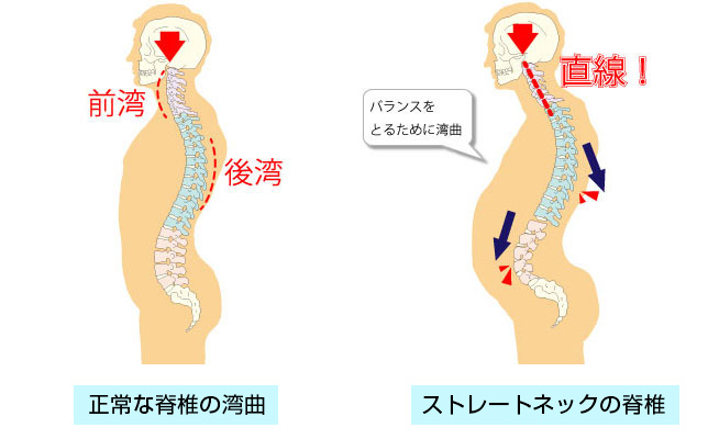 交通事故後、首の痛みが気になる…そんな時どうすればいい？